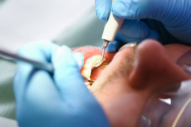 Best Emergency Denture Repair in South Henderson, NC